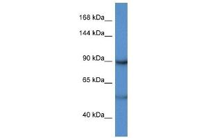 Western Blot showing LPIN2 antibody used at a concentration of 1 ug/ml against Hela Cell Lysate (Lipin 2 抗体  (C-Term))