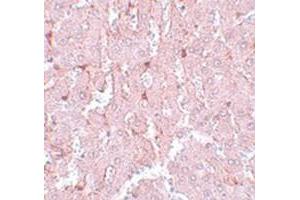 Immunohistochemical staining of rat liver tissue with NR1H3 polyclonal antibody  at 5 ug/mL dilution. (NR1H3 抗体  (N-Term))