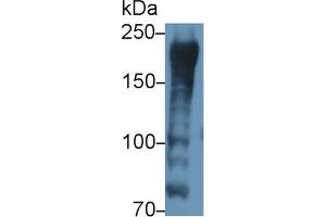 Detection of AKAP12 in Porcine Skeletal muscle lysate using Polyclonal Antibody to A Kinase Anchor Protein 12 (AKAP12) (AKAP12 抗体  (AA 1485-1782))