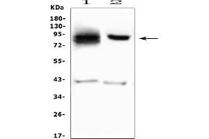 Western blot analysis of SMURF2 using anti-SMURF2 antibody (ABIN7601239).
