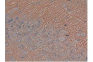 IHC-P analysis of Rat Brain Tissue, with DAB staining. (MAPT 抗体  (AA 34-368))