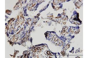 Immunoperoxidase of monoclonal antibody to DKK1 on formalin-fixed paraffin-embedded human placenta. (DKK1 抗体  (AA 1-266))