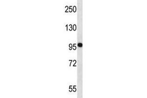 Western Blotting (WB) image for anti-Neural Precursor Cell Expressed, Developmentally Down-Regulated 9 (NEDD9) (AA 335-363) antibody (ABIN3031968)