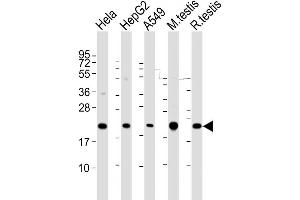 Western Blot at 1:2000 dilution Lane 1: Hela whole cell lysate Lane 2: HepG2 whole cell lysate Lane 3: A549 whole cell lysate Lane 4: mouse testis lysate Lane 5: rat testis lysate Lysates/proteins at 20 ug per lane.