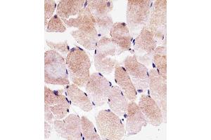 Immunohistochemical analysis of paraffin-embedded H. (SLC25A25 抗体  (N-Term))