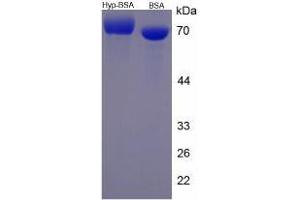 Image no. 1 for Hydroxyproline (Hyp) protein (BSA) (ABIN1880107) (Hydroxyproline Protein (Hyp) (BSA))