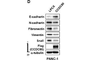 Ectopic expression of CCDC80 reducing migration, colony formation, and EMT in pancreatic cancer cells.