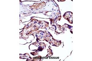 Immunohistochemistry (IHC) image for anti-Neural Precursor Cell Expressed, Developmentally Down-Regulated 9 (NEDD9) antibody (ABIN2998097) (NEDD9 抗体)