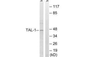 Western blot analysis of extracts from Jurkat cells, treated with PMA (125 ng/mL, 30 mins), using TAL-1 (Ab-122) antibody.