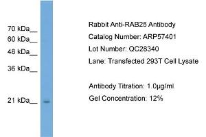 WB Suggested Anti-RAB25  Antibody Titration: 0. (RAB25 抗体  (Middle Region))