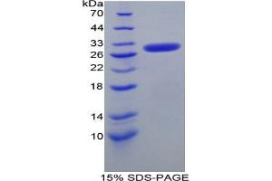 SDS-PAGE analysis of Mouse Nucleoporin 50 kDa Protein. (NUP50 蛋白)