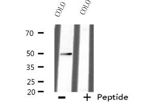 Western blot analysis of extracts from HepG2 cells, using AZI2 antibody. (AZI2 抗体  (N-Term))