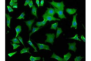Immunofluorescence staining of SH-SY5Y cells with ABIN7175790 at 1:50, counter-stained with DAPI. (WDR73 抗体  (AA 163-366))