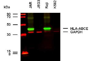 Anti-HLA-ABCE Purified (clone TP25. (HLA-A+B+C+E 抗体)
