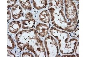 Immunohistochemical staining of paraffin-embedded Kidney tissue using anti-PSMC3 mouse monoclonal antibody. (PSMC3 抗体)