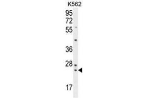 PAUF Antibody (Center) western blot analysis in K562 cell line lysates (35µg/lane). (ZG16B 抗体  (Middle Region))