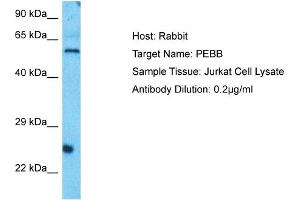 Host: Rabbit Target Name: PEBB Sample Type: Jurkat Whole Cell lysates Antibody Dilution: 0. (CBFB 抗体  (N-Term))