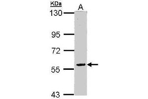 WB Image Sample (30 ug of whole cell lysate) A: Raji 7. (FAM126A 抗体)