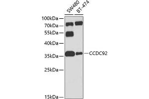 Western blot analysis of extracts of various cell lines, using CCDC92 antibody (ABIN6133294, ABIN6138046, ABIN6138047 and ABIN6224277) at 1:1000 dilution. (CCDC92 抗体  (AA 1-331))