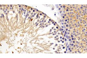 Detection of LPIN1 in Rat Testis Tissue using Polyclonal Antibody to Lipin 1 (LPIN1) (Lipin 1 抗体  (AA 729-924))