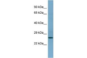 WB Suggested Anti-APIP Antibody Titration: 0. (APIP 抗体  (Middle Region))