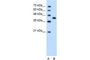 WB Suggested Anti-CEACAM6 Antibody Titration:  1. (CEACAM6 抗体  (Middle Region))