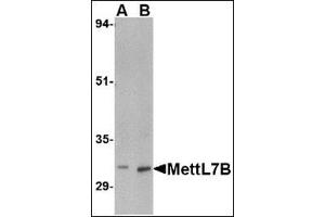 Western blot analysis of MettL7B in rat spleen tissue lysate with this product at (A) 2 and (B) 4 μg/ml. (METTL7B 抗体  (C-Term))