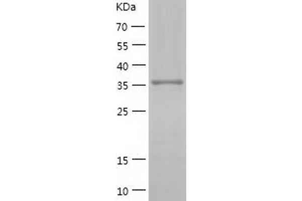 SHC1 Protein (AA 161-474) (His tag)