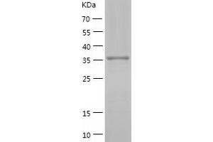Western Blotting (WB) image for SHC (Src Homology 2 Domain Containing) Transforming Protein 1 (SHC1) (AA 161-474) protein (His tag) (ABIN7125084)