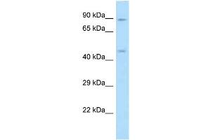 WB Suggested Anti-RGD1307830 Antibody Titration: 1. (ODR4 抗体  (C-Term))
