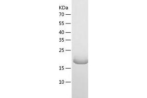 MOK Protein (AA 281-489) (His tag)