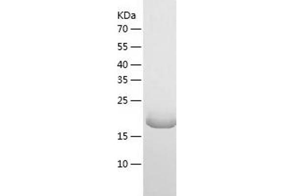 MOK Protein (AA 281-489) (His tag)