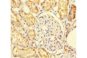 Immunohistochemistry of paraffin-embedded human kidney tissue using ABIN7170944 at dilution of 1:100 (SUOX 抗体  (AA 80-545))