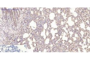 Immunohistochemistry of paraffin-embedded Mouse lung tissue using Desmin Monoclonal Antibody at dilution of 1:200. (Desmin 抗体)
