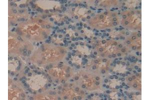 Detection of SYK in Human Kidney Tissue using Polyclonal Antibody to Spleen Tyrosine Kinase (SYK) (SYK 抗体  (AA 374-635))