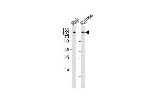 Western blot analysis of lysates from Raji, Ramos cell line (from left to right), using CD19 Antibody at 1:1000 at each lane.