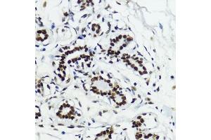 Immunohistochemistry of paraffin-embedded human breast using Acetyl-Histone H3-K27 antibody (ABIN7267670) at dilution of 1:200 (40x lens).