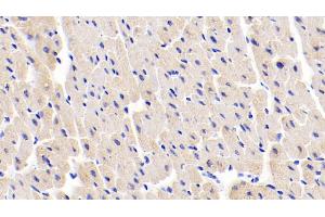 Immunohistochemistry (IHC) image for anti-Myosin, Light Chain 1, Alkali, Skeletal, Fast (MYL1) (AA 3-142) antibody (ABIN7433171)