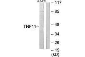 Western blot analysis of extracts from HuvEc cells, using TNFSF11 Antibody. (RANKL 抗体  (AA 41-90))