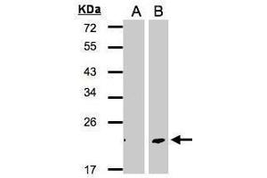 WB Image Western Blot analysis of DPT expression in transfected 293T cell line by DPT polyclonal antibody. (Dermatopontin 抗体)
