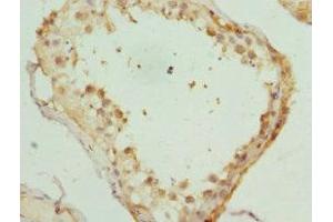 Immunohistochemistry of paraffin-embedded human testis tissue using ABIN7157650 at dilution of 1:100 (KIF3A 抗体  (AA 430-699))