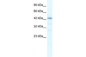 Western Blotting (WB) image for anti-SP140 Nuclear Body Protein-Like (SP140L) antibody (ABIN2461297) (SP140L 抗体)