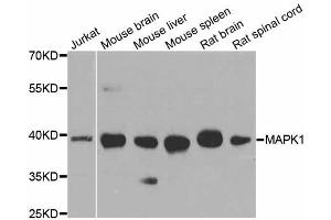 Western blot analysis of extracts of various cell lines, using MAPK1 antibody. (ERK2 抗体)