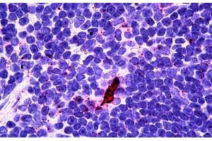 Human Lyphoid-Dendritic Cells: Formalin-Fixed, Paraffin-Embedded (FFPE) (EBI3 抗体)