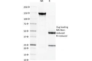 SDS-PAGE (SDS) image for anti-Spectrin, Beta, Non-erythrocytic 2 (SPTBN2) (AA 356-475) antibody (ABIN6940653)