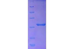 SDS-PAGE (SDS) image for Embryonic Stem Cell Related (Non-Protein Coding) (ESRG) (AA 1-222), (full length) protein (His tag) (ABIN5711347) (ESRG Protein (AA 1-222, full length) (His tag))