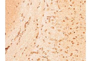 ABIN6267221 at 1/100 staining mouse brain tissue sections by IHC-P. (CHEK1 抗体  (pSer296))