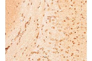 ABIN6267221 at 1/100 staining mouse brain tissue sections by IHC-P.