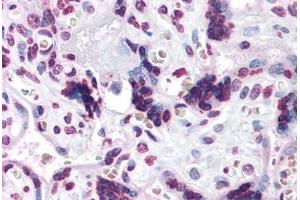 Human Placenta: Formalin-Fixed, Paraffin-Embedded (FFPE) (CARD14 抗体  (C-Term))