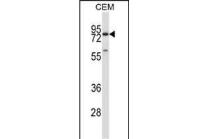 P16 Antibody (C-term) (ABIN657636 and ABIN2846632) western blot analysis in CEM cell line lysates (35 μg/lane). (MMP16 抗体  (C-Term))
